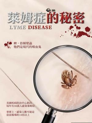 风险管理